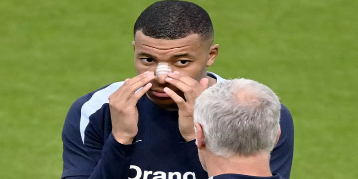 Cầu thủ Kylian Mbappe có thể dùng miếng dán bảo vệ mũi trong suốt để cùng đội tuyển Pháp thi đấu tại Euro 2024